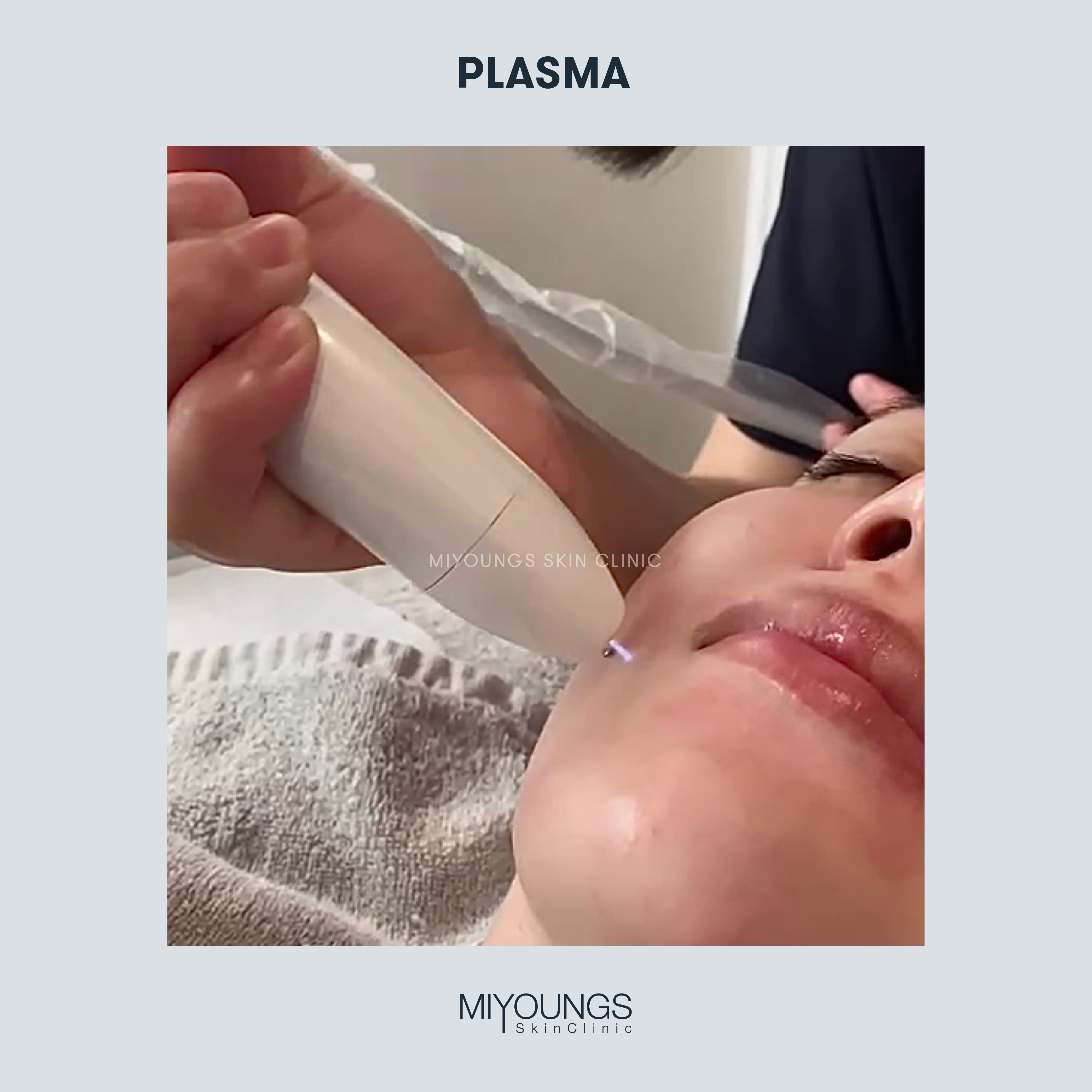 plasma-1-03